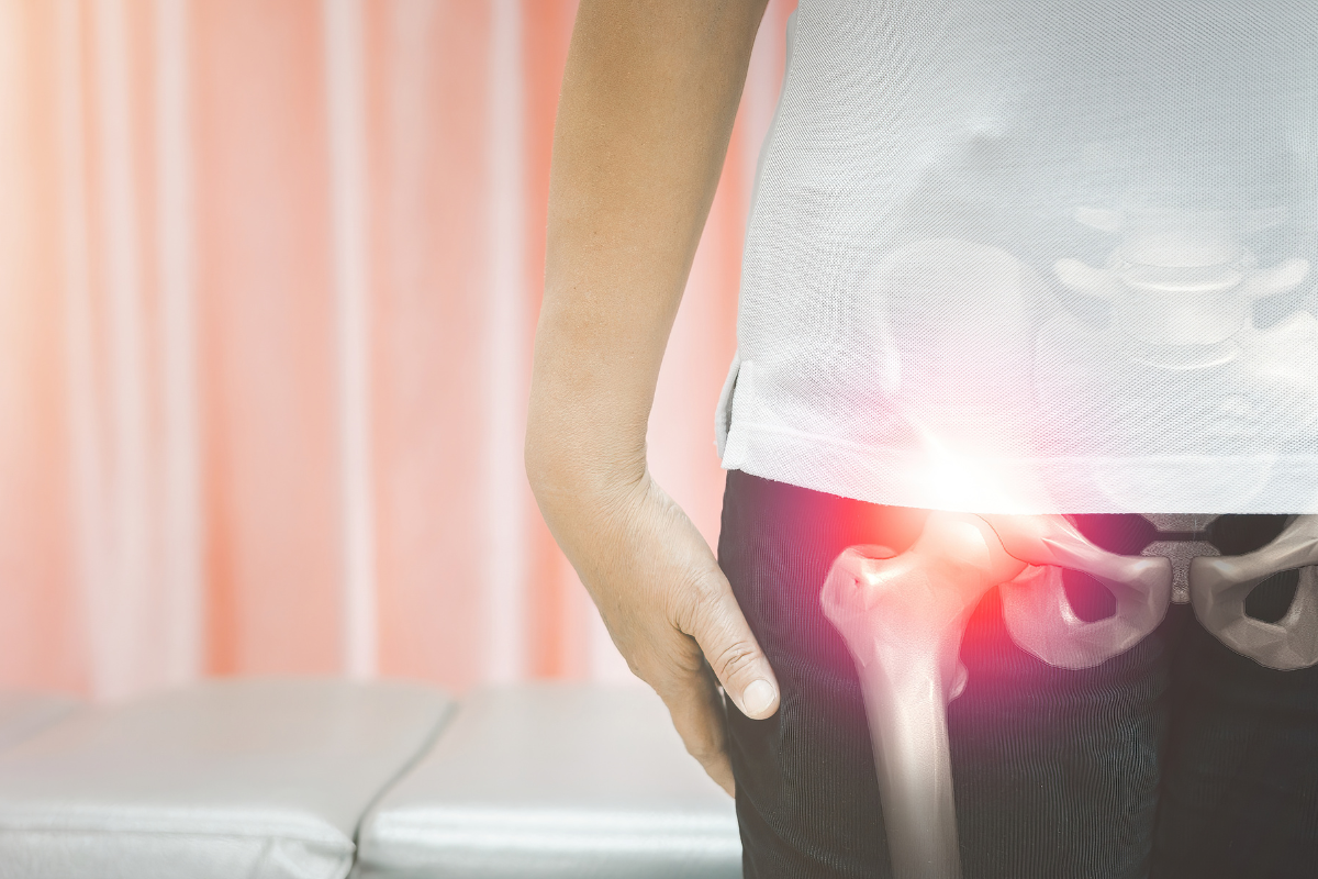 artrosi all'anca - come curarla - Centro Ortopedico e Fisioterapico Monteverde SanaMedical