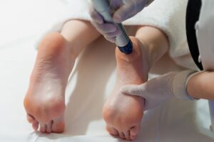 spina calcaneare onde d'urto - SanaMedical Body Rehab Roma Monteverde Nuovo